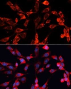 MRPS28 Antibody - Azide and BSA Free, Novus Biologicals 0.1 mL, Unconjugated:Antibodies,