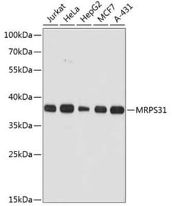 MRPS31 Antibody - Azide and BSA Free, Novus Biologicals:Antibodies:Primary