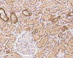 MRPS34 Antibody, Novus Biologicals 50 &mu;g | Buy Online | Novus Biologicals | Fisher Scientific