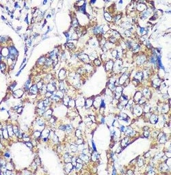 MRPS35 Antibody - Azide and BSA Free, Novus Biologicals 0.1 mL; Unconjugated:Antibodies,