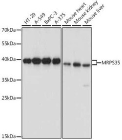 MRPS35 Antibody - Azide and BSA Free, Novus Biologicals 0.1 mL; Unconjugated:Antibodies,