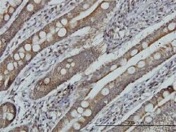 MRRF Antibody (1D3), Novus Biologicals 0.1 mg | Buy Online | Novus Biologicals | Fisher Scientific
