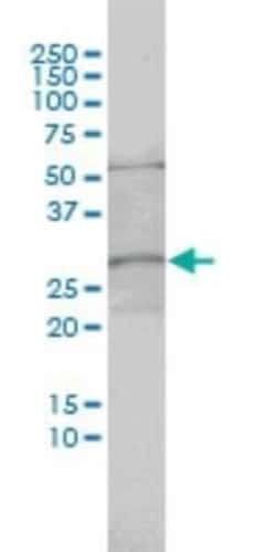 MRTO4 Antibody (1C12), Novus Biologicals 0.1 mg | Buy Online | Novus Biologicals | Fisher Scientific