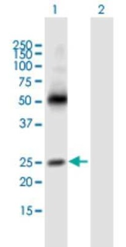 MS4A3 Antibody, Novus Biologicals 0.05 mg | Buy Online | Novus Biologicals | Fisher Scientific