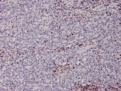 MSH2 Antibody (MSH2/2622) - Azide and BSA Free, Novus Biologicals 100 &mu;g;