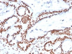 MSH2 Antibody (MSH2/2622) - Azide and BSA Free, Novus Biologicals 100 &mu;g;