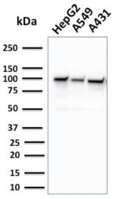 MSH2 Mouse anti-Human, Clone: MSH2/2622, Novus Biologicals 20 &mu;g; Unconjugated:Antibodies,
