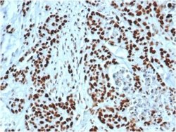 MSH2 Antibody (MSH2/6549R) - Azide and BSA Free, Novus Biologicals 100