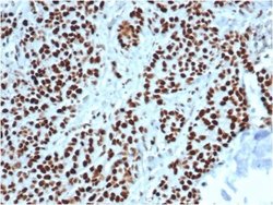 MSH2 Antibody (MSH2/6549R) - Azide and BSA Free, Novus Biologicals 100