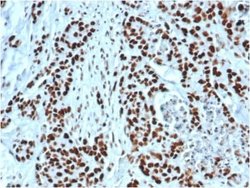 MSH2 Rabbit anti-Human, Clone: MSH2/6549R, Novus Biologicals:Antibodies:Primary