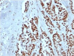 MSH2 Antibody (rMSH2/6548) - Azide and BSA Free, Novus Biologicals 100 &mu;g | Buy Online | Novus Biologicals | Fisher Scientific