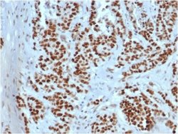 MSH2 Antibody (rMSH2/6548) - Azide and BSA Free, Novus Biologicals 100 &mu;g | Buy Online | Novus Biologicals | Fisher Scientific