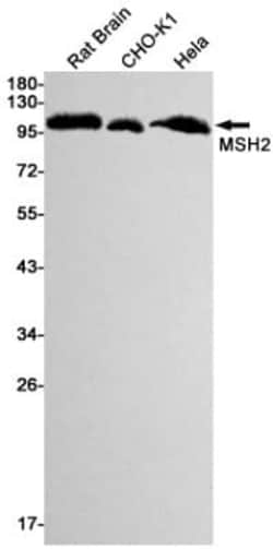 MSH2 Antibody (S04-8B4), Novus Biologicals 100 &mu;g; Unconjugated:Antibodies,