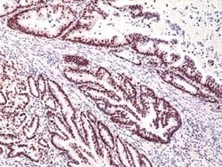 MSH3 Antibody (RM405), Novus Biologicals 100 &mu;L; Unconjugated:Antibodies,