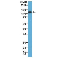 MSH3 Antibody (RM405), Novus Biologicals 100 &mu;L; Unconjugated:Antibodies,