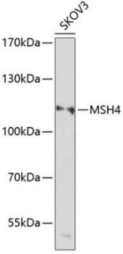 MSH4 Antibody - BSA Free, Novus Biologicals 0.1 mL; Unconjugated:Antibodies,