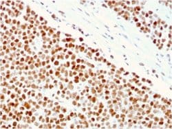 MSH6, Mouse anti-Human, Clone: MSH6/3086, Novus Biologicals:Antibodies:Primary