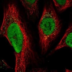 MSH6 Antibody, Novus Biologicals 25 &mu;L; Unconjugated:Antibodies, Polyclonal