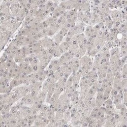 MSH6 Antibody, Novus Biologicals 25 &mu;L; Unconjugated:Antibodies, Polyclonal