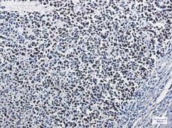 MSH6 Antibody (S05-2B5), Novus Biologicals:Antibodies:Primary Antibodies