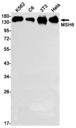 MSH6 Antibody (S05-2B5), Novus Biologicals:Antibodies:Primary Antibodies