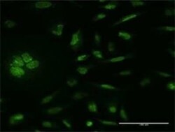 MSK1/RPS6KA5 Antibody (1G7), Novus Biologicals 0.1 mg | Buy Online | Novus Biologicals | Fisher Scientific