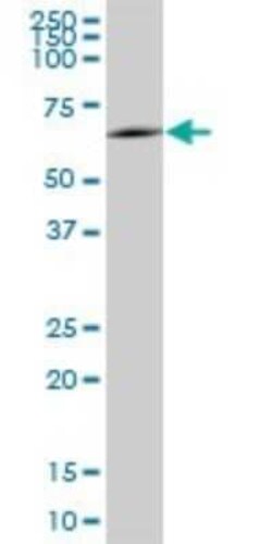 Novus Biologicals MSL3L1 Antibody, Novus Biologicals 0.05 mg | Buy Online | Novus Biologicals&trade; | Fisher Scientific