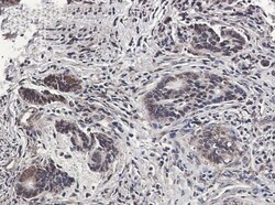 MSP/MST1 Antibody (S04-1D6), Novus Biologicals 100 &mu;g; Unconjugated:Antikörper