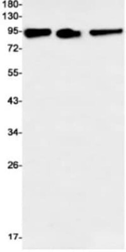MSP/MST1 Antibody (S04-1D6), Novus Biologicals 100 &mu;g; Unconjugated:Antikörper