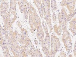 MSRB2 Antibody, Novus Biologicals 100 &mu;g; Unconjugated:Antibodies, Polyclonal