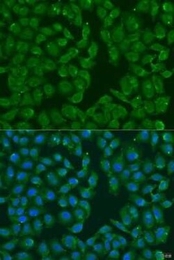 MSRB3 Antibody - BSA Free, Novus Biologicals 0.1 mL; Unconjugated:Antibodies,