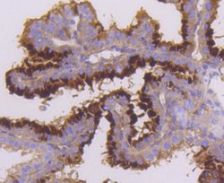 MST1/2 Rabbit anti-Human, Clone: SC05-83, Novus Biologicals 100&mu;L:Antibodies,