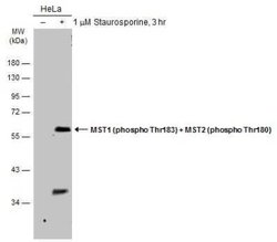 MST1/2, p Thr180 Antibody, Novus Biologicals 100 &mu;g | Buy Online | Novus Biologicals | Fisher Scientific