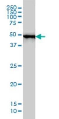 Novus Biologicals MST4 Antibody (2G6), Novus Biologicals 0.1 mg | Buy Online | Novus Biologicals&trade; | Fisher Scientific