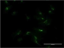 MSX1 Antibody (1E2), Novus Biologicals 0.1 mg | Buy Online | Novus Biologicals | Fisher Scientific