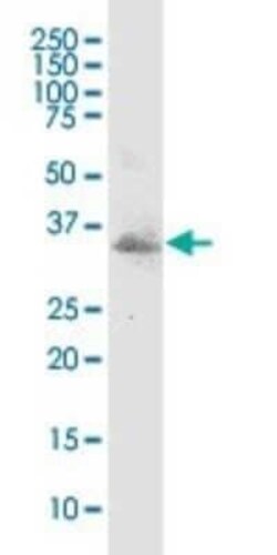 MSX1 Antibody (1E2), Novus Biologicals 0.1 mg | Buy Online | Novus Biologicals | Fisher Scientific