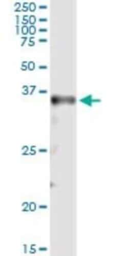 Novus Biologicals MSX2 Antibody (1E8), Novus Biologicals 0.1 mg | Buy Online | Novus Biologicals&trade; | Fisher Scientific