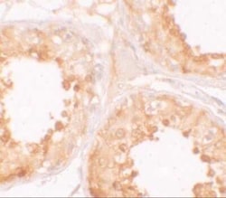 MSY2 Antibody - BSA Free, Novus Biologicals 0.1 mg; Unconjugated:Anticorps,