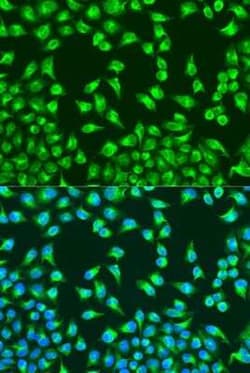 MT-CO2 Antibody - BSA Free, Novus Biologicals 0.02 mL | Buy Online | Novus Biologicals | Fisher Scientific