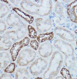 MT-CO2 Antibody - BSA Free, Novus Biologicals 0.02 mL | Buy Online | Novus Biologicals | Fisher Scientific