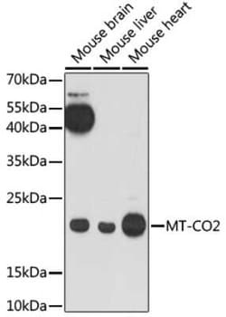 MT-CO2 Antibody - Azide and BSA Free, Novus Biologicals 0.02 mL, Unconjugated:Antibodies,