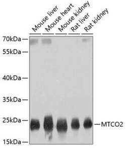 MT-CO2 Antibody - BSA Free, Novus Biologicals 0.1 mL | Buy Online | Novus Biologicals | Fisher Scientific