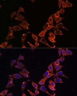 MT-ND4 Antibody - Azide and BSA Free, Novus Biologicals 0.02 mL; Unconjugated:Antibodies,