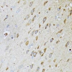 MT-ND5 Antibody - BSA Free, Novus Biologicals 20 &mu;g; Unconjugated:Antibodies,