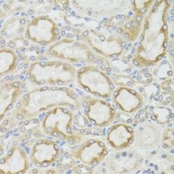 MT-ND5 Antibody - BSA Free, Novus Biologicals 20 &mu;g; Unconjugated:Antibodies,