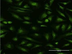 MTA1 Antibody (1C3), Novus Biologicals 0.1 mg, Unconjugated:Antibodies,