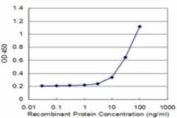 MTA1 Antibody (1C3), Novus Biologicals 0.1 mg, Unconjugated:Antibodies,