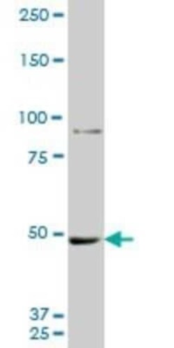 MTA1 Antibody (1C3), Novus Biologicals 0.1 mg, Unconjugated:Antibodies,