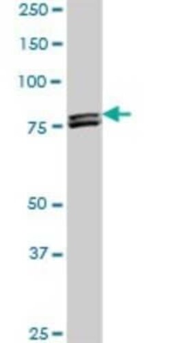 MTA1 Antibody (4D5), Novus Biologicals 0.1 mg | Buy Online | Novus Biologicals | Fisher Scientific