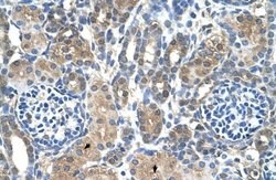 MTA2 Antibody, Novus Biologicals 100 &mu;L; Unconjugated:Antibodies, Polyclonal